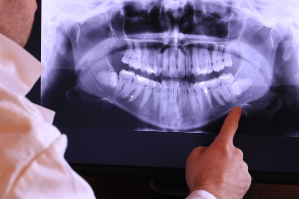Best Emergency Dental Care for Abscessed Tooth in Weslaco, TX