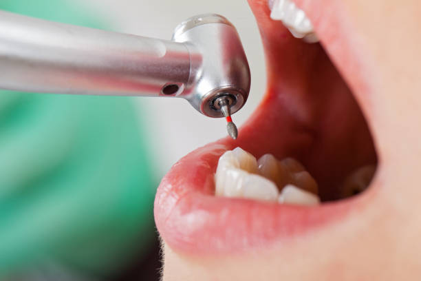 Best Mobile Emergency Dentist in Weslaco, TX